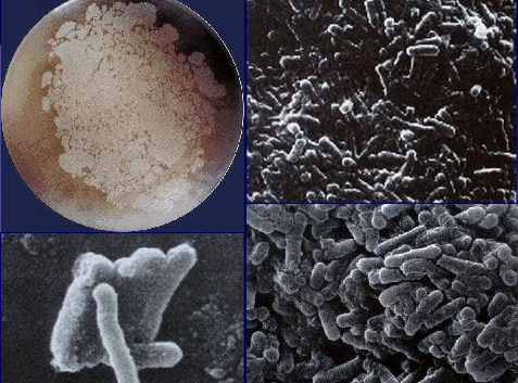 Sulla scoperta dei cristallomicrobi Cryms, batteri in animazione sospesa